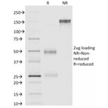 SDS-PAGE - Anti-Annexin A1 Antibody [ANXA1/1671] - BSA and Azide free (A251992) - Antibodies.com