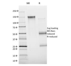 SDS-PAGE - Anti-Annexin A1 Antibody [ANXA1/1672] - BSA and Azide free (A251993) - Antibodies.com