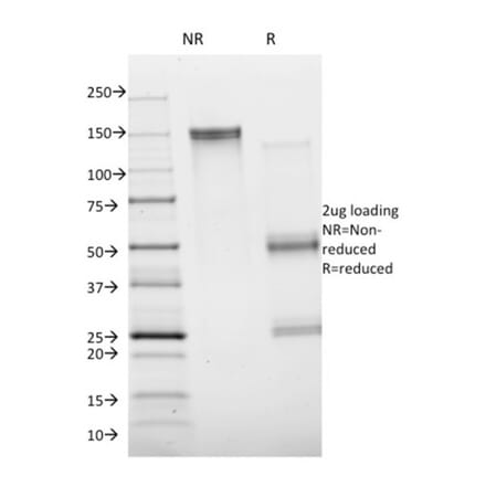 SDS-PAGE - Anti-Annexin A1 Antibody [ANXA1/1672] - BSA and Azide free (A251993) - Antibodies.com