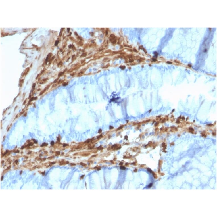 Immunohistochemistry - Anti-Annexin A1 Antibody [CPTC-ANXA1-1] - BSA and Azide free (A251993) - Antibodies.com