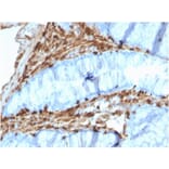 Immunohistochemistry - Anti-Annexin A1 Antibody [CPTC-ANXA1-1] - BSA and Azide free (A251993) - Antibodies.com