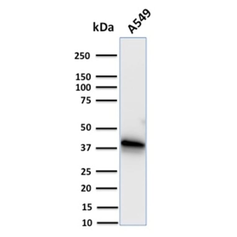 Western Blot - Anti-Annexin A1 Antibody [CPTC-ANXA1-1] - BSA and Azide free (A251994) - Antibodies.com