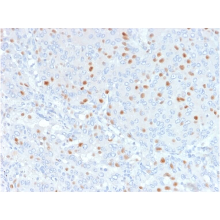 Immunohistochemistry - Anti-Annexin A1 Antibody [6E4/3] - BSA and Azide free (A251995) - Antibodies.com