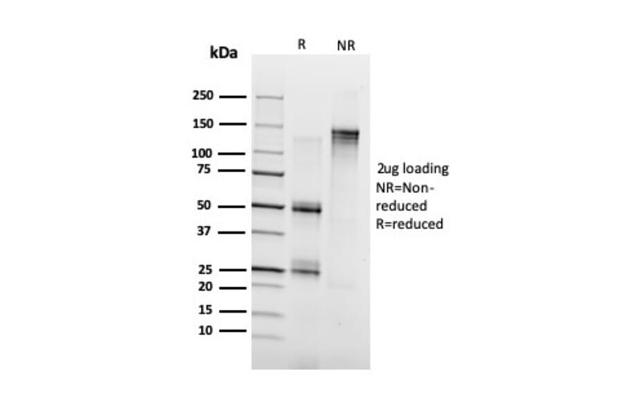 SDS-PAGE - Anti-Annexin A1 Antibody [ANXA1/3728] - BSA and Azide free (A251998) - Antibodies.com
