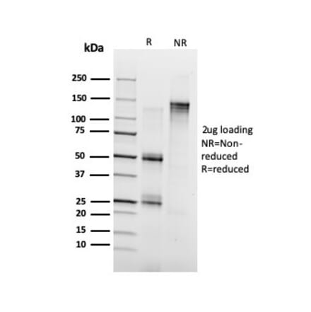 SDS-PAGE - Anti-Annexin A1 Antibody [ANXA1/3728] - BSA and Azide free (A251998) - Antibodies.com