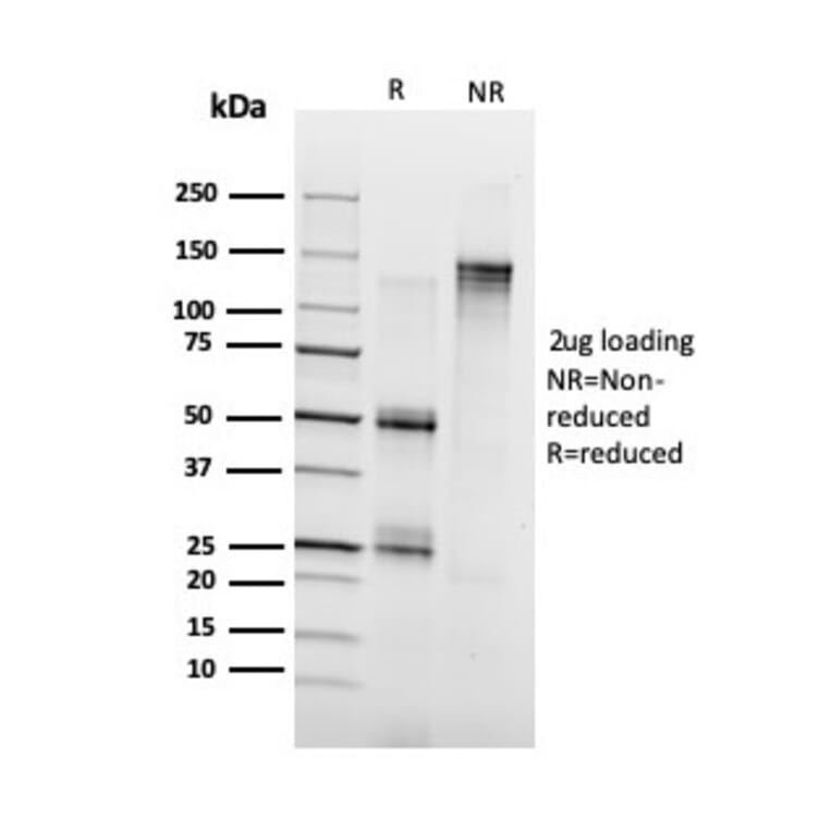 SDS-PAGE - Anti-Annexin A1 Antibody [ANXA1/3728] - BSA and Azide free (A251998) - Antibodies.com