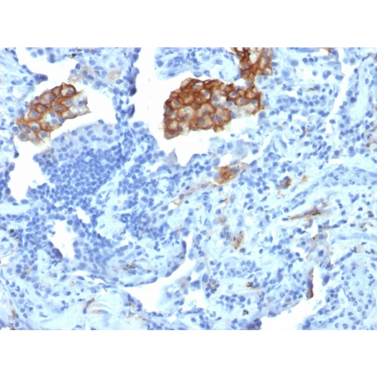 Immunohistochemistry - Anti-DC-SIGN Antibody [C209/1781] - BSA and Azide free (A252002) - Antibodies.com