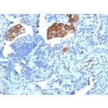 Immunohistochemistry - Anti-DC-SIGN Antibody [C209/1781] - BSA and Azide free (A252002) - Antibodies.com