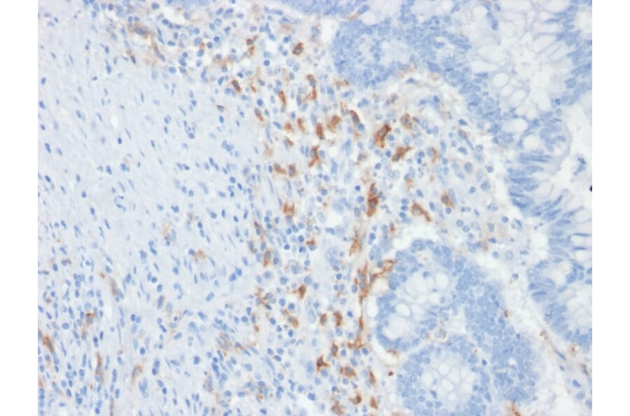 Immunohistochemistry - Anti-DC-SIGN Antibody [C209/1781] - BSA and Azide free (A252000) - Antibodies.com