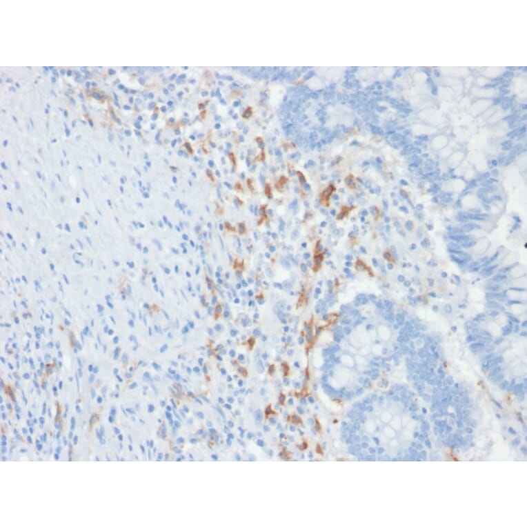 Immunohistochemistry - Anti-DC-SIGN Antibody [C209/1781] - BSA and Azide free (A252000) - Antibodies.com