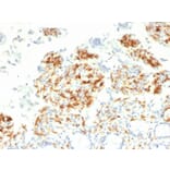 Immunohistochemistry - Anti-DC-SIGN Antibody [C209/1781] - BSA and Azide free (A252002) - Antibodies.com