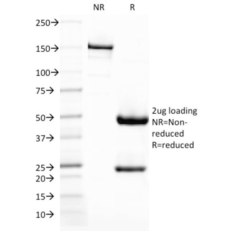SDS-PAGE - Anti-DC-SIGN Antibody [C209/1781] - BSA and Azide free (A252002) - Antibodies.com