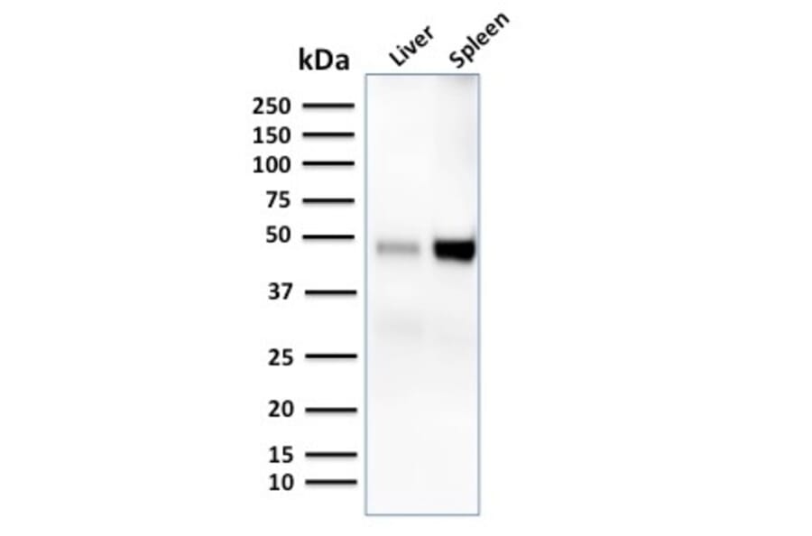 Western Blot - Anti-DC-SIGN Antibody [C209/1781] - BSA and Azide free (A252002) - Antibodies.com