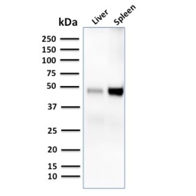 Western Blot - Anti-DC-SIGN Antibody [C209/1781] - BSA and Azide free (A252002) - Antibodies.com
