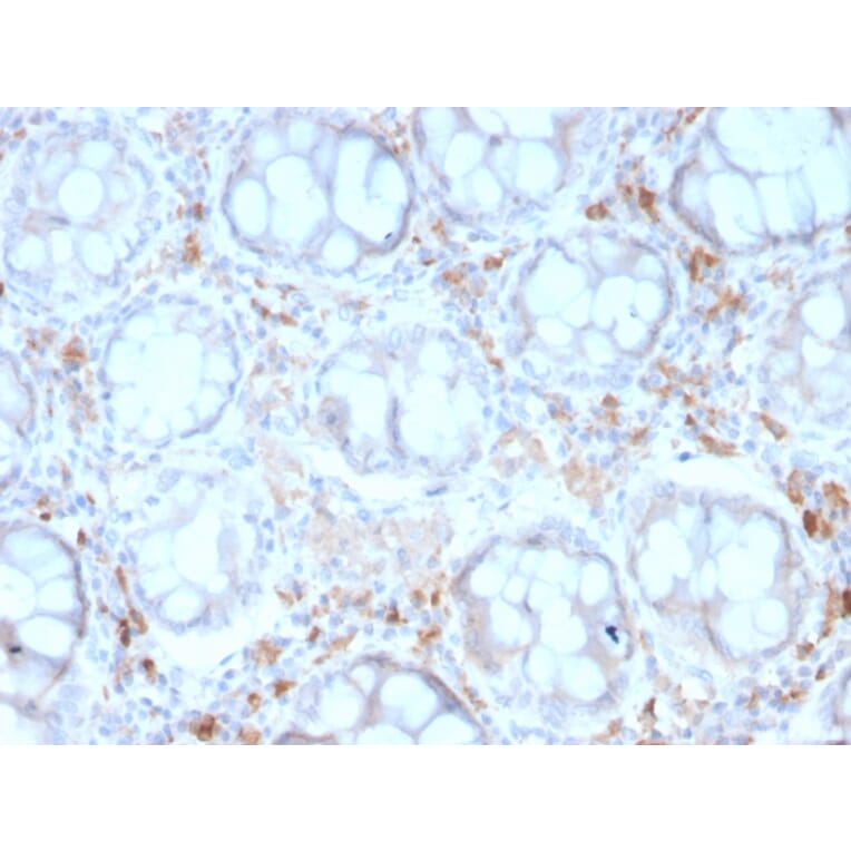 Immunohistochemistry - Anti-DC-SIGN Antibody [rC209/1781] - BSA and Azide free (A252002) - Antibodies.com