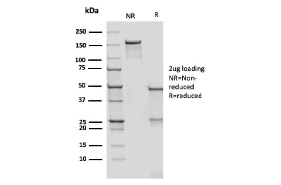 SDS-PAGE - Anti-DC-SIGN Antibody [rC209/1781] - BSA and Azide free (A252003) - Antibodies.com