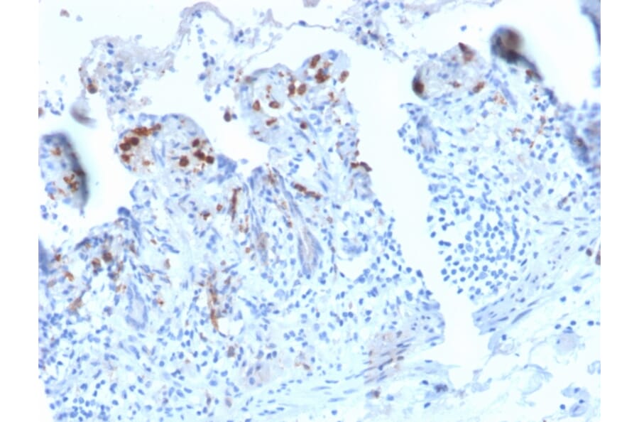Immunohistochemistry - Anti-DC-SIGN Antibody [C209/2749R] - BSA and Azide free (A252003) - Antibodies.com