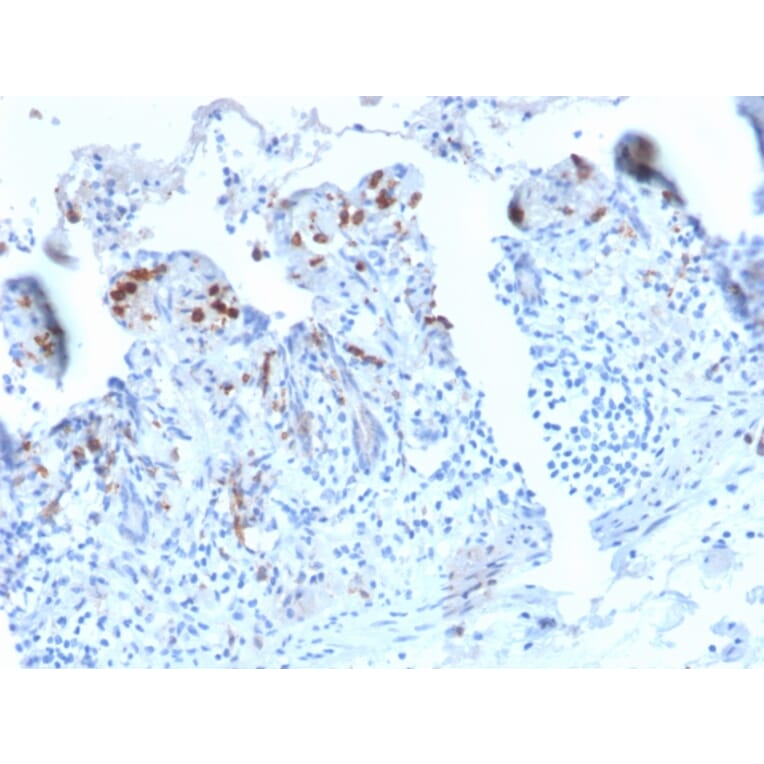 Immunohistochemistry - Anti-DC-SIGN Antibody [C209/2749R] - BSA and Azide free (A252003) - Antibodies.com