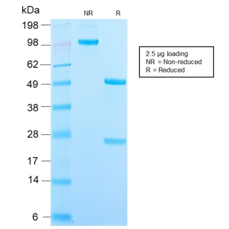 SDS-PAGE - Anti-DC-SIGN Antibody [C209/2749R] - BSA and Azide free (A252004) - Antibodies.com