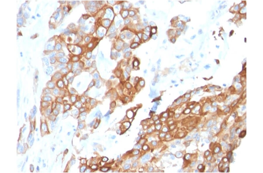 Immunohistochemistry - Anti-Heregulin Antibody [NRG1/2710] - BSA and Azide free (A252005) - Antibodies.com