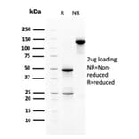 SDS-PAGE - Anti-Heregulin Antibody [NRG1/2710] - BSA and Azide free (A252005) - Antibodies.com