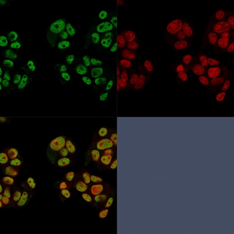 Immunofluorescence - Anti-Heregulin Antibody [NRG1/2752] - BSA and Azide free (A252006) - Antibodies.com
