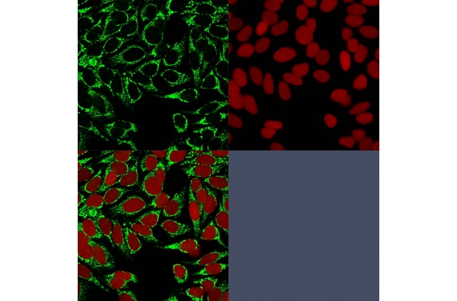 Immunofluorescence - Anti-HIF1 alpha Antibody [HIF1A/84] - BSA and Azide free (A252006) - Antibodies.com