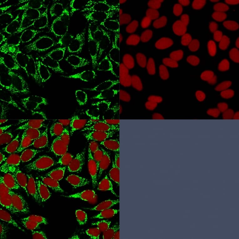 Immunofluorescence - Anti-HIF1 alpha Antibody [HIF1A/84] - BSA and Azide free (A252006) - Antibodies.com