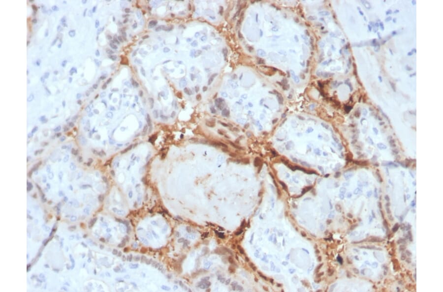 Immunohistochemistry - Anti-HIF1 alpha Antibody [Ha111a] - BSA and Azide free (A252009) - Antibodies.com