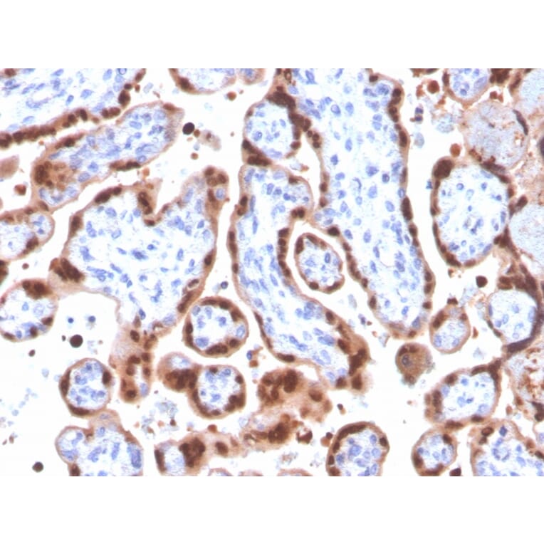 Immunohistochemistry - Anti-HIF1 alpha Antibody [Ha111a] - BSA and Azide free (A252008) - Antibodies.com