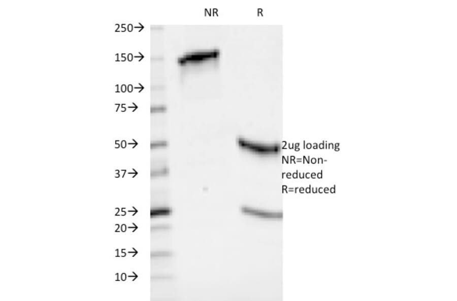 SDS-PAGE - Anti-HLA ABC Antibody [246-B8.E7] - BSA and Azide free (A252009) - Antibodies.com