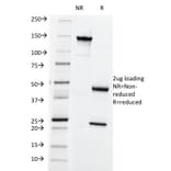 SDS-PAGE - Anti-HLA ABC Antibody [SPM419] - BSA and Azide free (A252010) - Antibodies.com