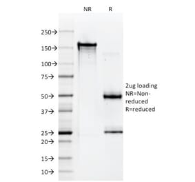 SDS-PAGE - Anti-HLA A Antibody [108-2C5] - BSA and Azide free (A252012) - Antibodies.com