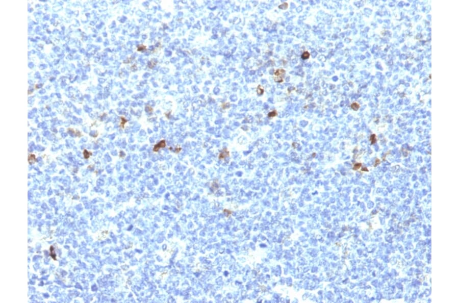 Immunohistochemistry - Anti-HLA Aw32 + HLA A25 Antibody [CATA-1] - BSA and Azide free (A252012) - Antibodies.com
