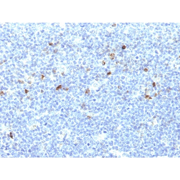 Immunohistochemistry - Anti-HLA Aw32 + HLA A25 Antibody [CATA-1] - BSA and Azide free (A252012) - Antibodies.com