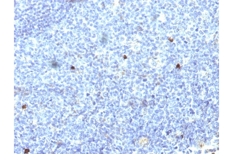 Immunohistochemistry - Anti-HLA Aw32 + HLA A25 Antibody [SPM418] - BSA and Azide free (A252013) - Antibodies.com