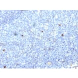 Immunohistochemistry - Anti-HLA Aw32 + HLA A25 Antibody [SPM418] - BSA and Azide free (A252013) - Antibodies.com