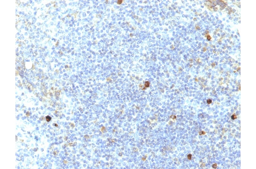 Immunohistochemistry - Anti-HLA Aw32 + HLA A25 Antibody [SPM417] - BSA and Azide free (A252014) - Antibodies.com
