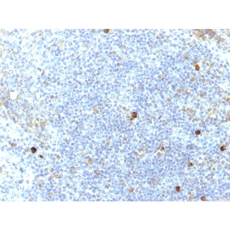 Immunohistochemistry - Anti-HLA Aw32 + HLA A25 Antibody [SPM417] - BSA and Azide free (A252014) - Antibodies.com