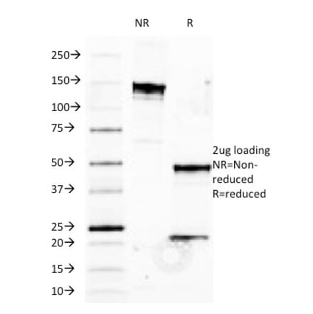 SDS-PAGE - Anti-HLA B Antibody [JOAN-1] - BSA and Azide free (A252015) - Antibodies.com
