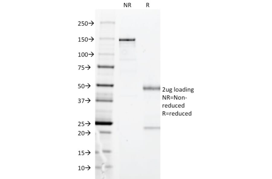 SDS-PAGE - Anti-HLA DP Antibody [BRA-FB6] - BSA and Azide free (A252018) - Antibodies.com