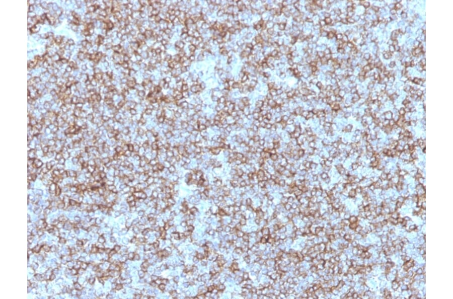 Immunohistochemistry - Anti-HLA DP + DR Antibody [Bra-14] - BSA and Azide free (A252019) - Antibodies.com