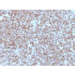 Immunohistochemistry - Anti-HLA DP + DR Antibody [Bra-14] - BSA and Azide free (A252019) - Antibodies.com