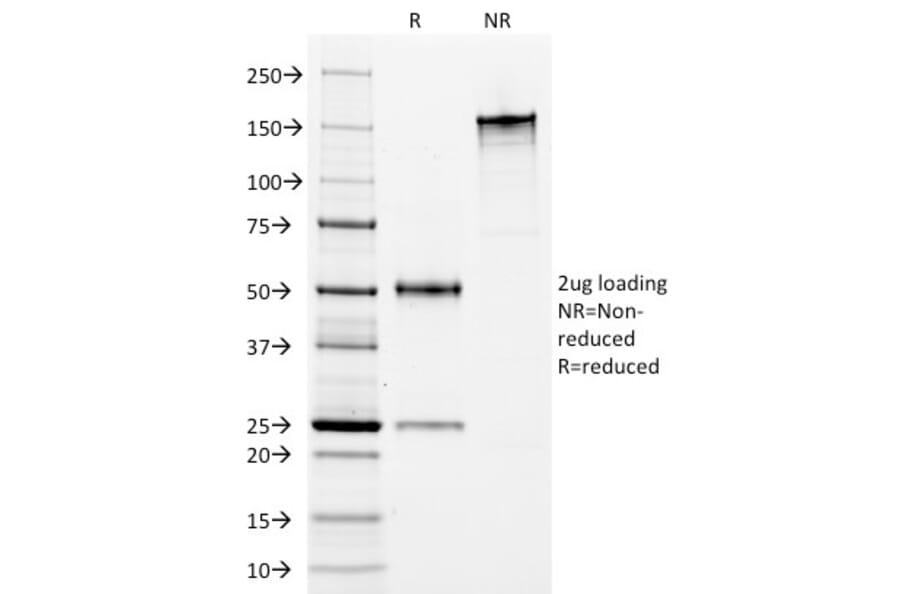 SDS-PAGE - Anti-HLA DP + DR Antibody [Bra-14] - BSA and Azide free (A252020) - Antibodies.com