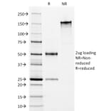 SDS-PAGE - Anti-HLA DP + DR Antibody [Bra-14] - BSA and Azide free (A252020) - Antibodies.com