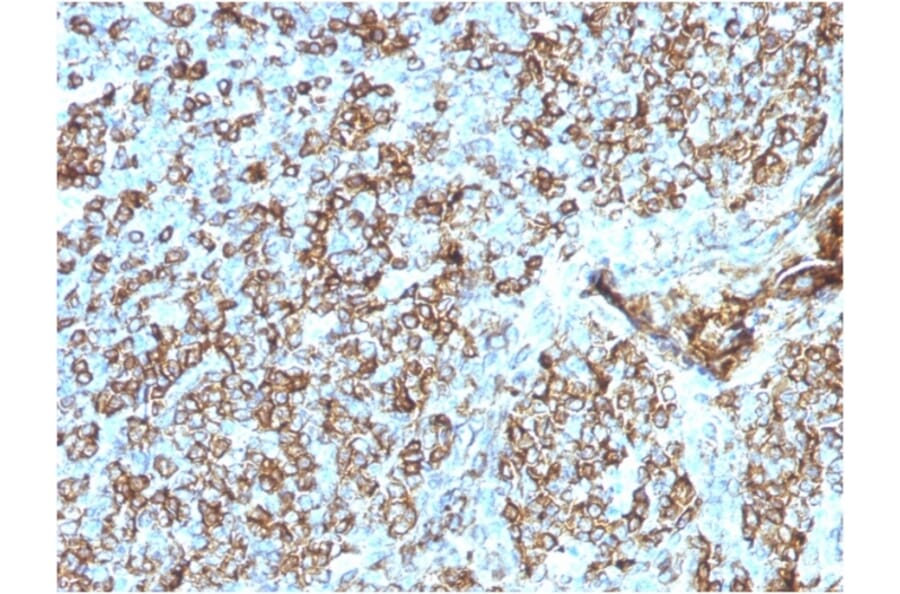 Immunohistochemistry - Anti-HLA DP + DQ + DR Antibody [CR3/43] - BSA and Azide free (A252021) - Antibodies.com