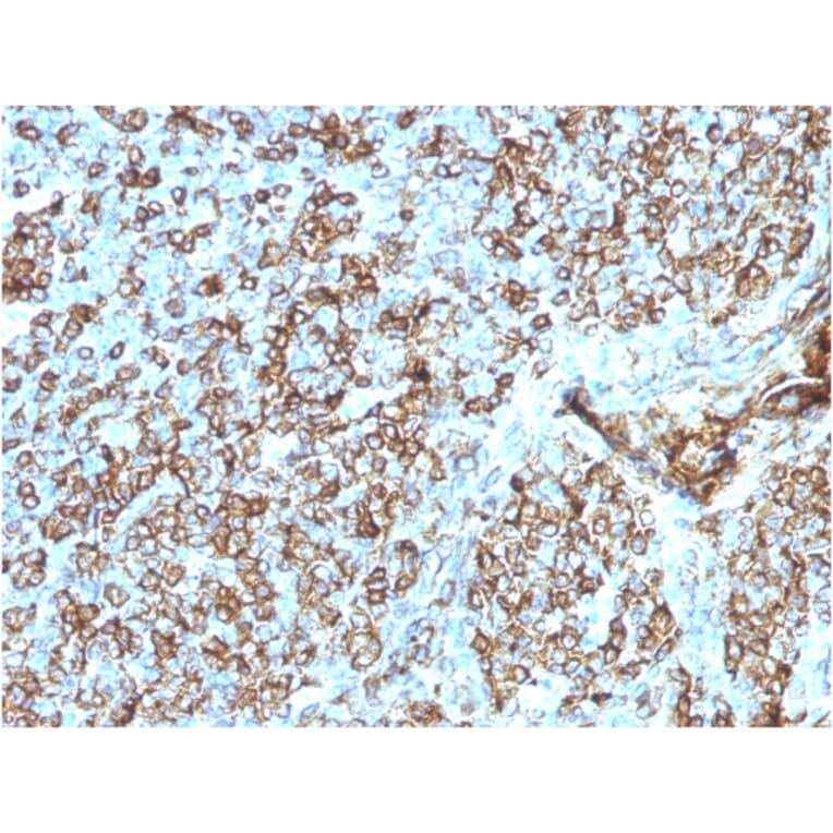 Immunohistochemistry - Anti-HLA DP + DQ + DR Antibody [CR3/43] - BSA and Azide free (A252021) - Antibodies.com