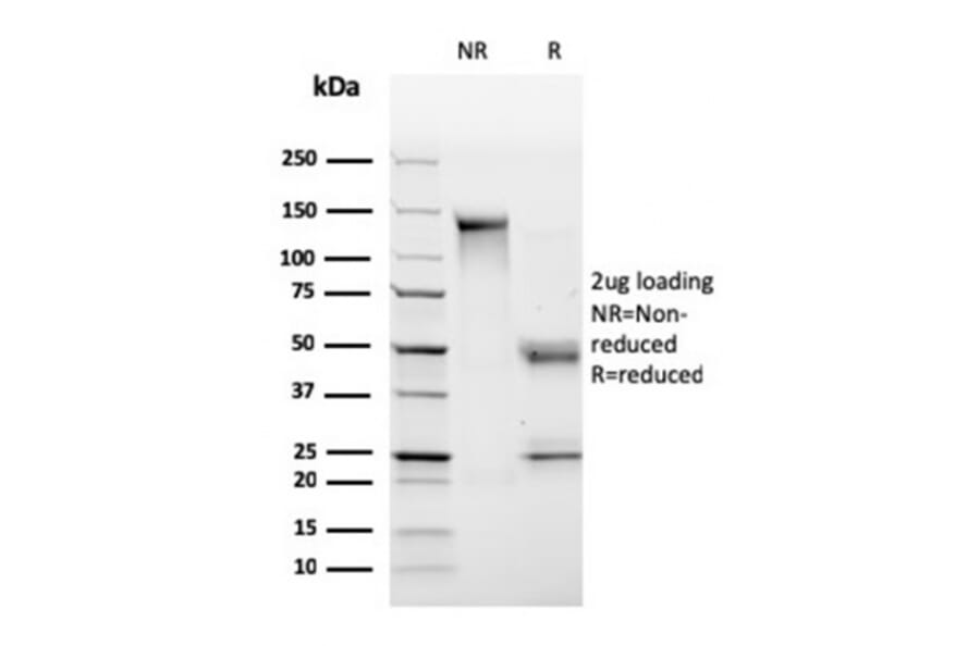 SDS-PAGE - Anti-HLA DP + DQ + DR Antibody [CR3/43] - BSA and Azide free (A252021) - Antibodies.com
