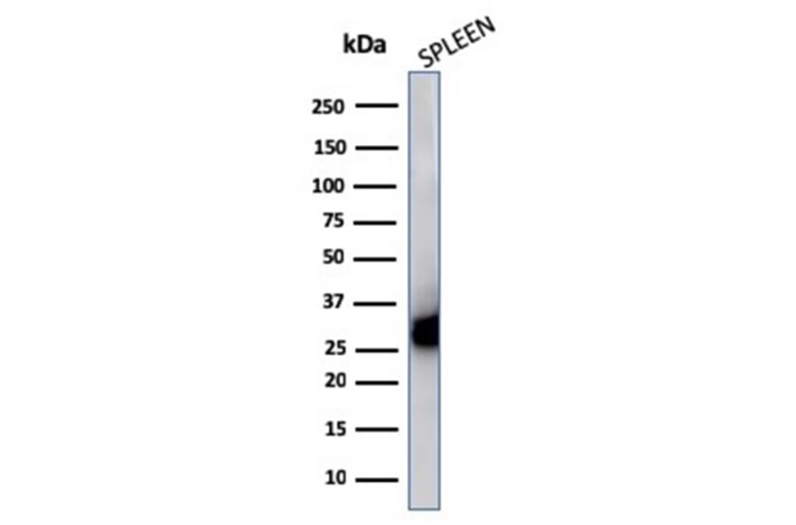 Western Blot - Anti-HLA DP + DQ + DR Antibody [CR3/43] - BSA and Azide free (A252021) - Antibodies.com