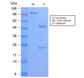 SDS-PAGE - Anti-HLA DP Antibody [HLA-DPB1/2862R] - BSA and Azide free (A252022) - Antibodies.com